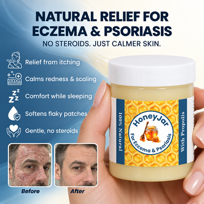 HoneyJar - Steroid Free Balm for Eczema & Psoriasis